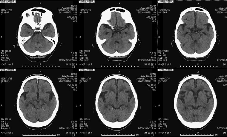 脳神経外科のイメージ